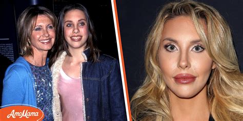 Chloe Lattanzis plastic surgery transformation